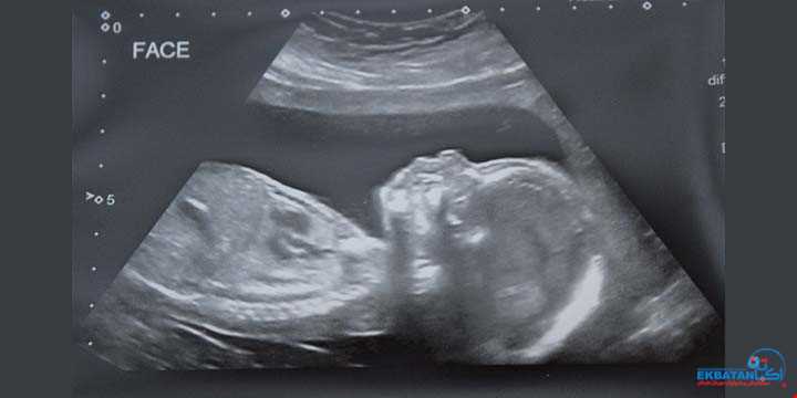 غربالگری سه ماهه دوم بارداری (اسکن آنومالی) | سونوگرافی و رادیولوژی دیجیتال اکباتان | دکتر بهنام غیاثوند