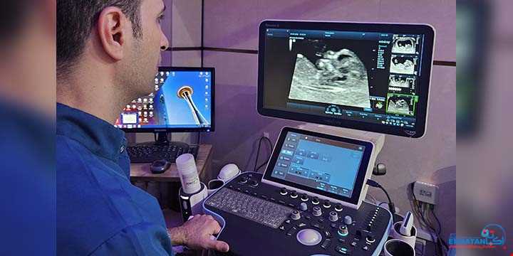 غربالگری مرحله اول (NT) | سونوگرافی و رادیولوژی دیجیتال اکباتان | دکتر بهنام غیاثوند